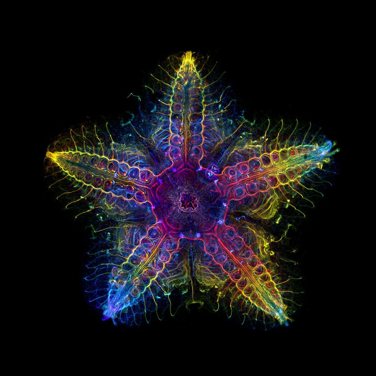 The Global Winner The global winning image was taken by Laurent Formery (USA). Nervous system of a juvenile sea star (Patiria miniata) about 1 cm wide. Labeled with an antibody against acetylated tubulin after optical clearing, and captured using a color-coded Z-projection.