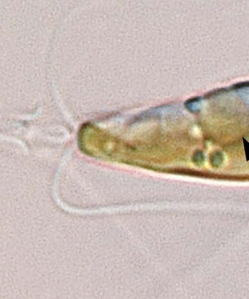 A bacterium has evolved into a new cellular structure inside algae