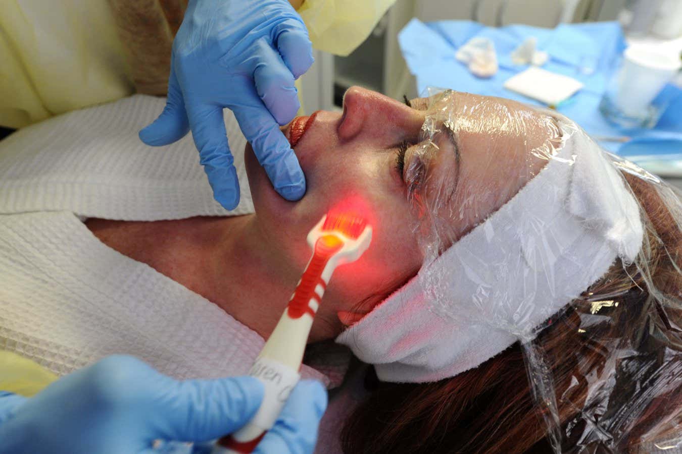 Microneedling demonstration by Dr. Jimmy Poon where a number of local Estheticans were introduced to the procedure that some see as unsafe.Dr Poon uses the Microneedle roller on the face of Esthetician Karen Clarke.(October 30 11)RICK EGLINTON/TORONTO STAR. (Photo by Rick Eglinton/Toronto Star via Getty Images)