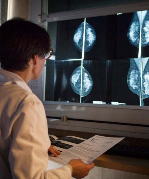 AI helps radiologists spot breast cancer in real-world tests