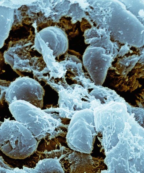 Ancient ancestor of the plague discovered in Bronze Age sheep