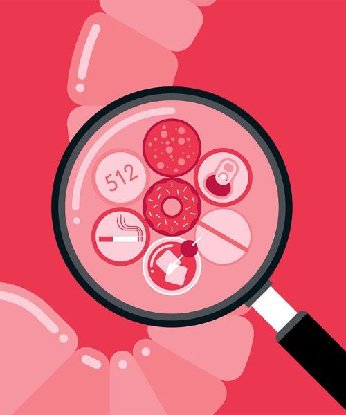 The alarming rise of colorectal cancer diagnoses in people under 50