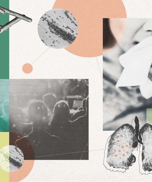 TB’s extraordinary evolution reveals why the ancient disease lives on