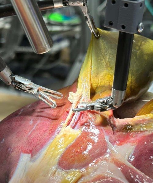 Surgical robots take step towards fully autonomous operations