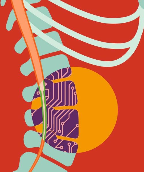 The futuristic new tech that could bridge broken nerves and mend minds