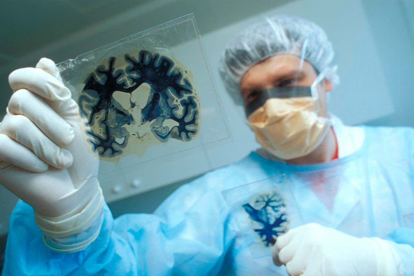 A person, dressed in scrubs and a face mask, examining slides with brain sections, infected by mad cow disease