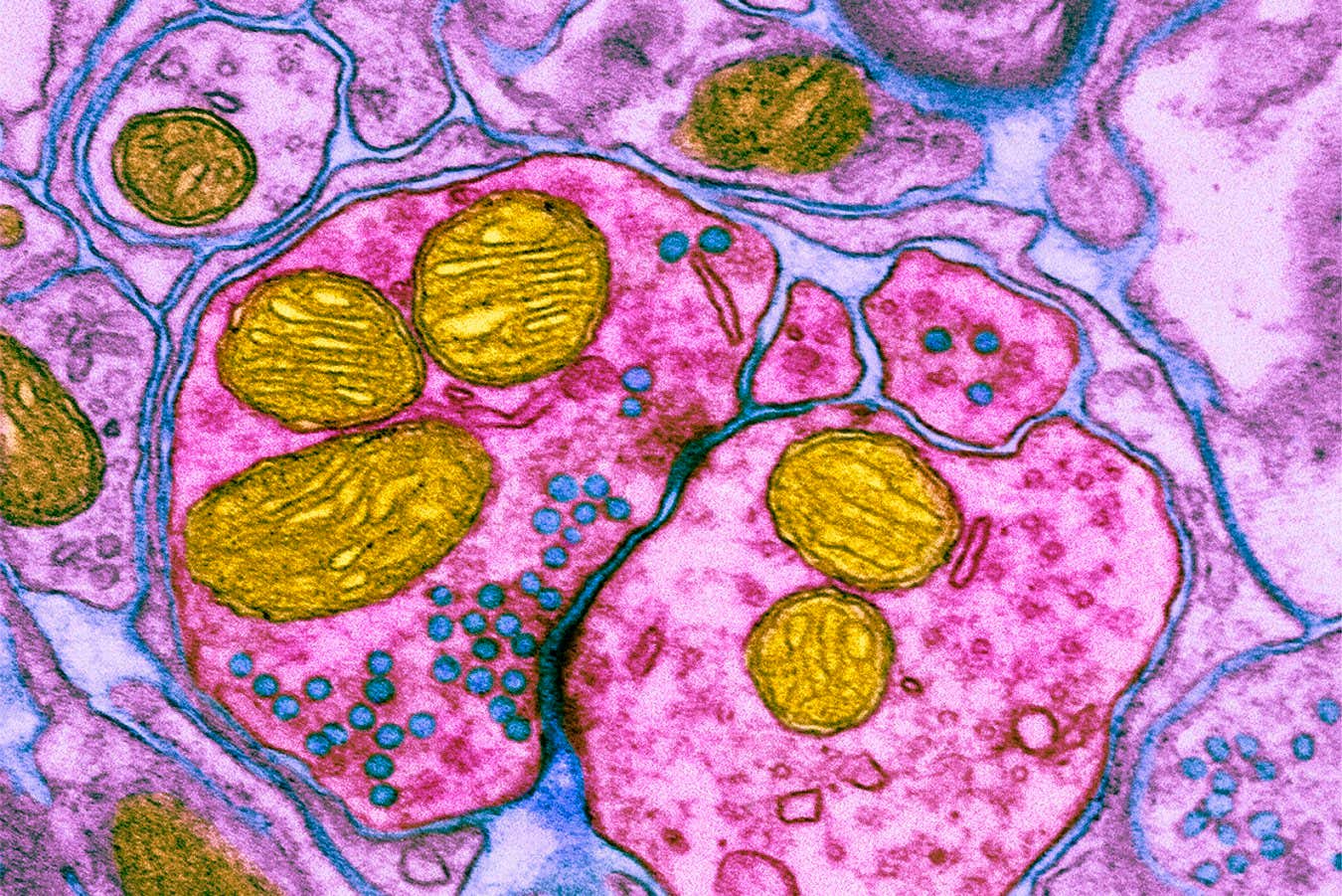 Coloured transmission electron micrograph (TEM) of a synapse, a junction between two nerve cells, in the brain. 